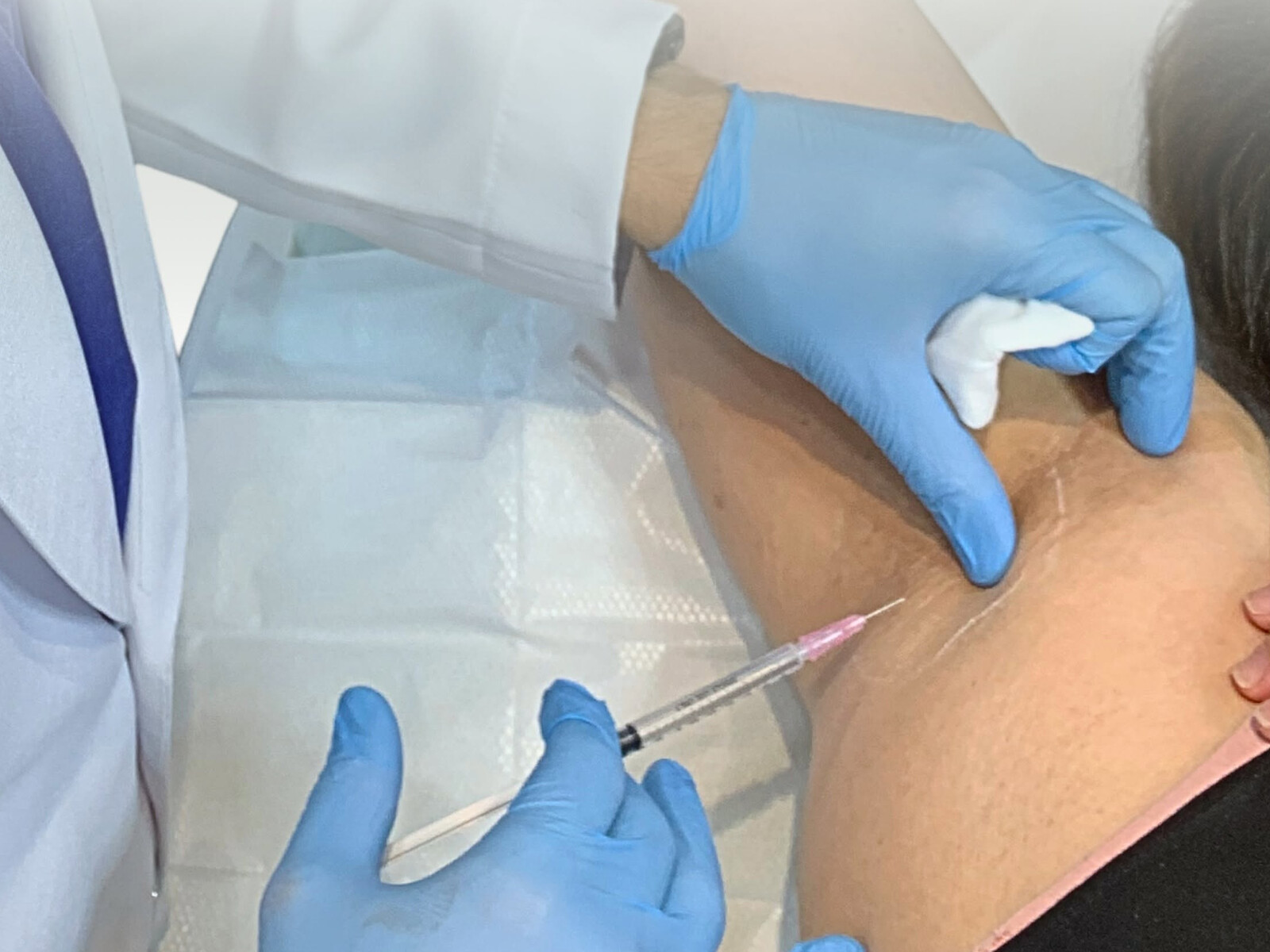 A fine-gauge injection being delivered into the axilla, gloved hands on a sterile drape.